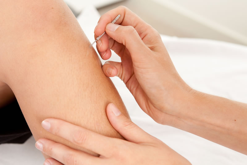 accupuncture for children